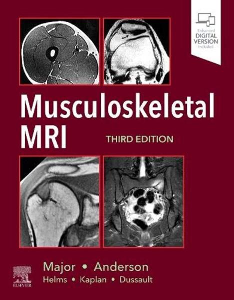 major & andersonMusculoskeletal MRI  2020 - رادیولوژی